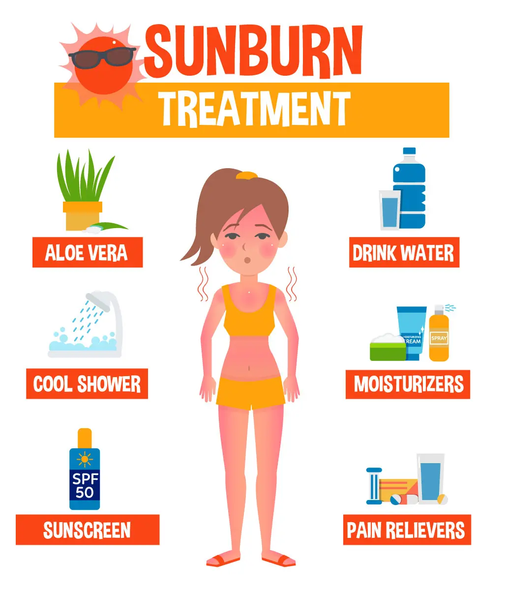 Graphic showing options for sunburn treatment